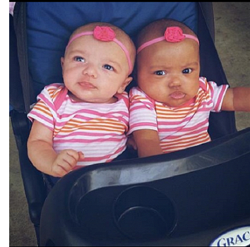 Родились разноцветные близнецы